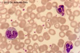 Image result for Platelet Count