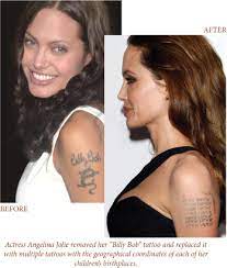 It goes to the extra length of removing or. Removing Unwanted Tattoos