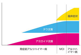 アルツハイマーは、知れば知るほど、とても奥が深い脳の状態。母にとってどっちが幸せなんだろうか。悩みに悩む・・・今回は「毎アル」続編（仮）の中で描かれる断片をちょっとだけww the more you learn. ã‚¢ãƒ«ãƒ„ãƒã‚¤ãƒžãƒ¼ç—… èªçŸ¥ç—‡ã®è¨ºæ–­ æ²»ç™‚ è¿'ç•¿å¤§å­¦ç—…é™¢