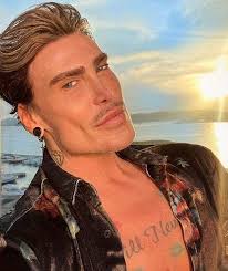 This 47-year-old man claims that he will defy aging through multiple  cosmetic surgeries. What are your thoughts?