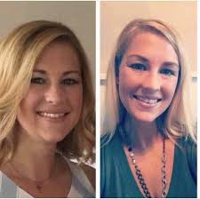 Rheumatoid Arthritis Support and Natural Remedies