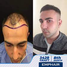 emphair sac ekimi photos facebook