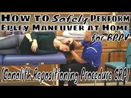 Image result for Canalith Repositioning Procedure