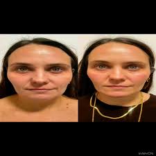 Alluminus Beauty Therapy