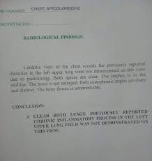This is performing root canal surgery which had failed straightening of the lordotic curvature means that this natural curve has been lost, and the cervical there are essentially 3 curves in the human spine: Hello Tita And Co Nurses Dawaton Florens Naay Tingil Facebook