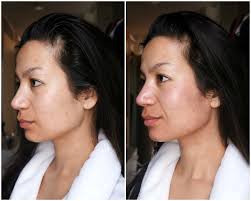 Snelle oplossing voor pigmentvlekken ⋆ Beautylab.nl