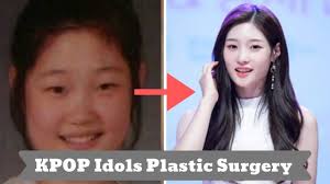 7 Kpop Idols With Their Plastic Surgery Story Youtube