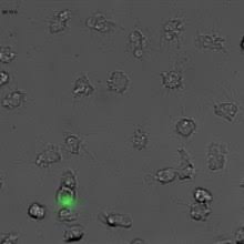 Auswerfen von mit proteinen umhüllten strängen (=net) aus granulären proteinen und nukleären bestandteilen Neutrophiler Granulozyt Wikipedia