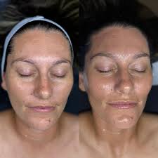 🍂✨ Autumn is in the air, and so is glowing skin. 🍂✨ Treat yourself to one  of our seasonal specials and fall in love with your complexion. Available  now through September 30th