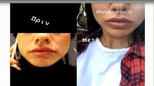 Στο after dark ήταν η κόνι μεταξά και προέβη σε αποκαλύψεις, όπως το μεγαλύτερο ποσό που πήρε για μία ανάρτηση στο instagram, τις πλαστικές επεμβάσεις αλλά αναφέρθηκε και στον σύντροφό της, μάριο καπότση. Zwza Meta3a E3allh Egina Me Thn Korh Moy Koni Poy Ebale Xeilh