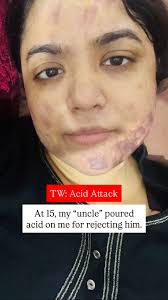 When I saw Akshay walk in, I couldn't hold it back any longer. It had been  an emotional day already