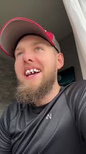 This Man Has TWO Sets Of Teeth?! 😬🦷 #teeth #braces #dentist