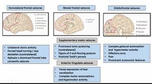 Seized конфиг, seized config 2019, seized.cfg, seized csgo settings, seized cfg cs 1.6, seized cs go config. Hashtag Seizure Na Twitteru