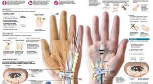 Dolor En Mano Causas Sintomas Y Tratamiento Clinica Universidad De Navarra