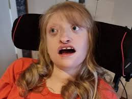 Co Down mum's plea for 'life-changing' wheelchair for disabled daughter