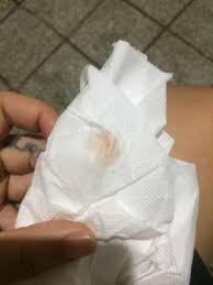 12 Dias De Atraso E Um Corrimento Rosa Sera Que E Gravidez Babycenter