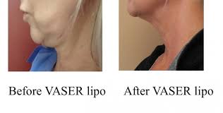 Visit this page to learn about the business and what locals in west roxbury have to say. Before After Cosmetic Surgery Medical Face Body Aesthetics