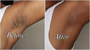 Caring for your skin between waxes will make the hair removal process easier. How I Wax My Own Armpits Youtube