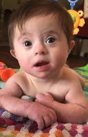 La possibilità di concepire un bambino con sindrome di down è in assoluto bassa, ma la probabilità aumenta proporzionalmente con l'età della madre; Abbandonata Alla Nascita Perche Affetta Dalla Sindrome Di Down Oggi Ha I