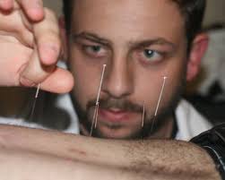 Acupuncture Pain & Wellness