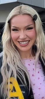 Findet ihr Shirin David hübsch? (Liebe, Sex, Beauty)