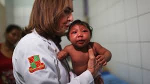 Image result wey dey for images of zika babies\