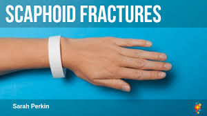 Scaphoid Fractures The triangular depression on the back of the hand between the thumb and the index finger | meaning, pronunciation, translations and examples. scaphoid fractures