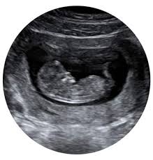 نتیجه جستجوی لغت [scans] در گوگل