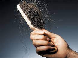 Hair shedding often stops on its own. Black Hair Shedding In Long Strands