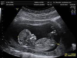 Learn about and revise sound, sound waves, hearing and ultrasound, and investigating the earth's structure with gcse bitesize physics. Ultrasound Wikipedia