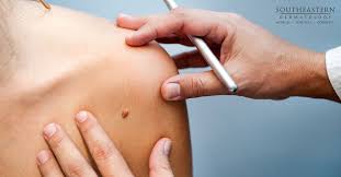 We'll dive into these questions in this guide and at the end go through the steps you should take to start regularly checking your skin. 6 Things You Should Know Before Your Skin Screening Southeastern Dermatology
