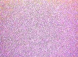 Red blood cells also have a nucleus during their stages of development. Blood Smear Human