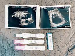 What might i see during a miscarriage? What To Expect During A Miscarriage My Story Wellness For The Win