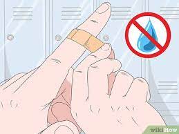 How To Treat A Cut Finger: 11 Steps (With Pictures) - Wikihow