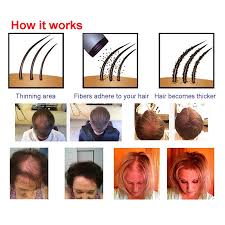 Toppik does no cause hair loss any more than sawdust would. Toppik Hair Building Fibers Powder For Men And Women