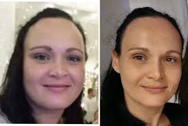 Maintaining weight loss after 70kg reduction