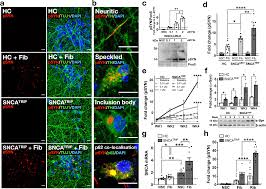 Stated effects are based on an aggregate of . Phenotypic Manifestation Of A Synuclein Strains Derived From Parkinson S Disease And Multiple System Atrophy In Human Dopaminergic Neurons Nature Communications