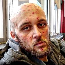 Keberkesanan rawatan dan pemulihan penagihan dadah: Lelaki Kongsi Pete Si Oyen Jadi Penguat Semangat Bantu Pulih Ketagihan Dadah