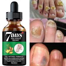 7DAYS Tratamiento de hongos en las uñas Esencia Suero Cuidado Cuidado de manos y pies Eliminación Gel reparador Antiinfeccioso | Walmart en línea