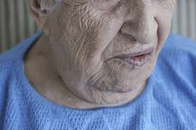 Vitamin therapy, using b6, b12 and zinc. Bell S Palsy Facts Causes Symptoms Complications Treatment Factdr