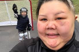 Fundraiser for Angie Peck by Sam Robles : Moyamoya Day Awareness for Angie!