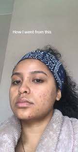 Drink Plenty of Water Girl Before and After