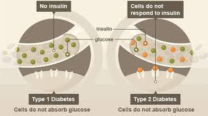 Symptoms of diabetes type two. Diabetes In Cats Causes Symptoms Treatment Catpointers