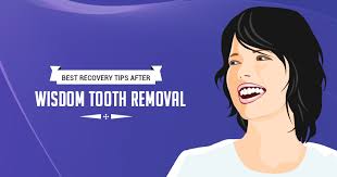 A common side effect following the removal of wisdom teeth is local swelling. 12 Tips On How To Recover From Wisdom Teeth Removal Fast