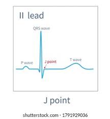Image result for J Point