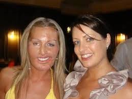 Woman who suffered third degree burns to 90 per cent of her body as a baby  has 100 operations costing £800k