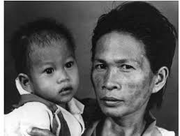 PDF) Mother, Child, Race, Nation: The Visual Iconography of Rescue and the  Politics of Transnational and Transracial Adoption