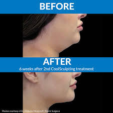 Dermatology and Laser Centre of Studio City