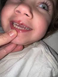 Getting Rid of Pacifier