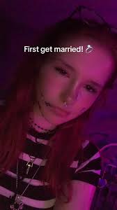 Ignore the pimple patches ;-;